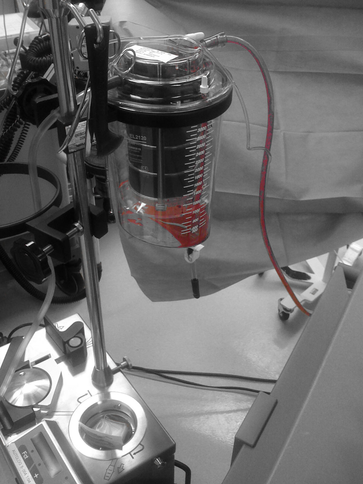 How does Autotransfusion work?